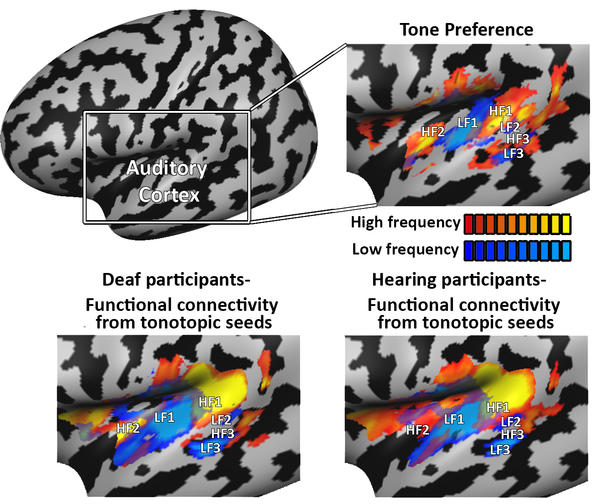 Tonotopic functional connectivity network organization in the deaf